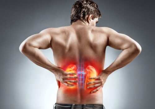 kidney stones pain in lower back